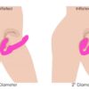 Inflatable Vibrating Strapless Strap-On: World’s First